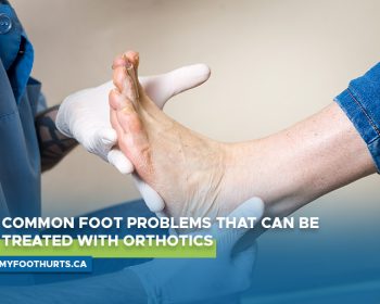 Common Foot Problems That Can Be Treated With Orthotics